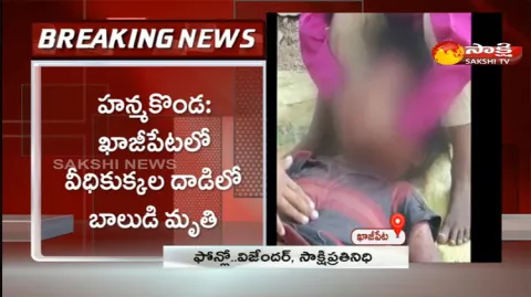Dog Attack On Boy In Hanmakonda