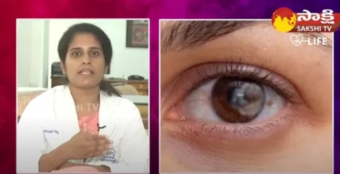 Dr Pragnya Rao Give Clarity on Cataract Surgery On Both Eyes At The Same Time? 
