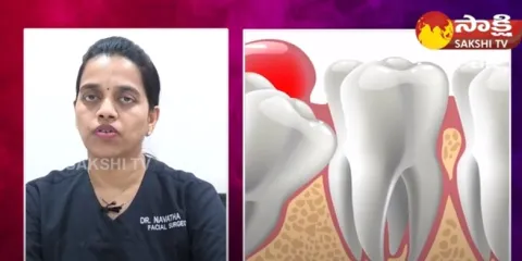 Wisdom Tooth Removal