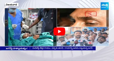 YS Avinash Reddy Reaction On CM YS Jagan Stone Hit Incident 
