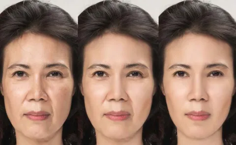 Beauty Tips: How To Tighten Skin On The Face And Neck