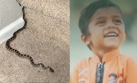 Snakebites in Children
