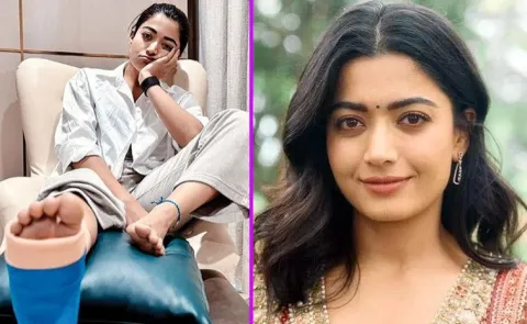 Rashmika Leg Injury Latest Update