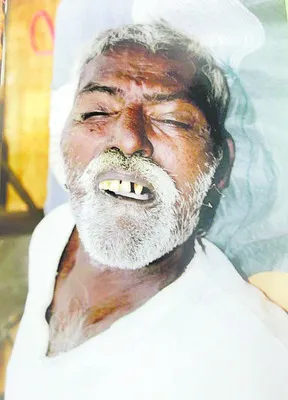 చికిత