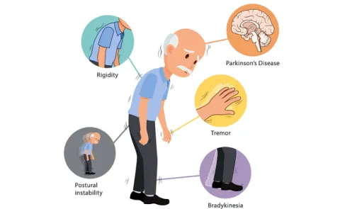 MR Guided Focused Ultrasound Treatment For Parkinsons Disease
