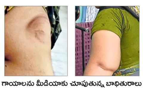Police beat up woman over land issue