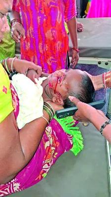 కుక్కల దాడిలో పసి బాలుడికి గాయాలు