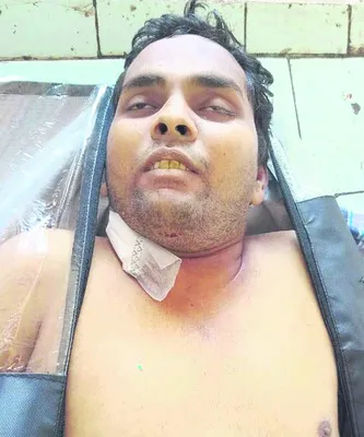 చెల్లి మరణం తట్టుకోలేక అన్న ఆత్మహత్య 