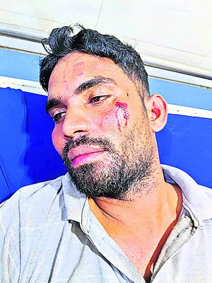 రామతీర్థంలో  జనసేన – టీడీపీ నాయకుల కొట్లాట 