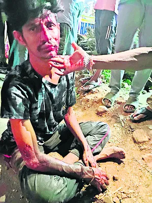 రోడ్డు ప్రమాదంలో ఇద్దరికి గాయాలు