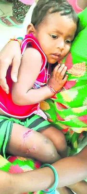 పిచ్చికుక్కల దాడిలో బాలుడికి తీవ్రగాయాలు