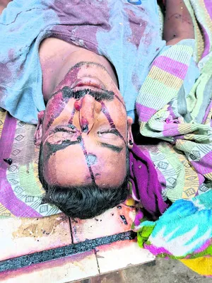 కుక్కను తప్పించబోయి.. 