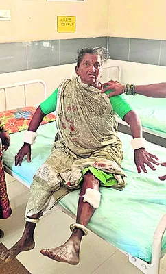 కుక్క దాడిలో ఉపాధి కూలీకి గాయాలు 