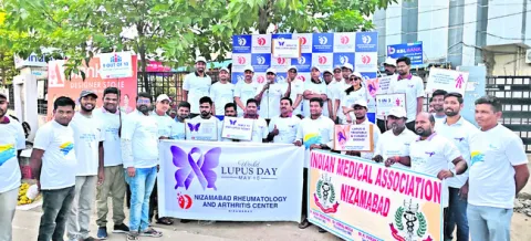‘లూపస్‌’పై అవగాహన అవసరం 