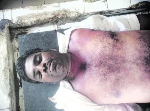 మద్యం అతిగా సేవించి వ్యక్తి మృతి  