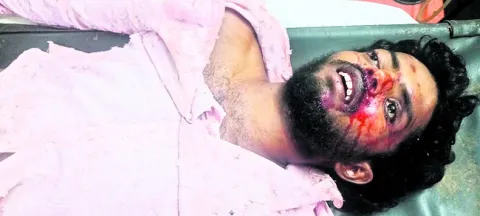 రోడ్డు ప్రమాదంలో యువకుడి దుర్మరణం