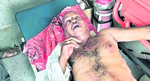 కుక్కల దాడిలో పలువురికి గాయాలు
