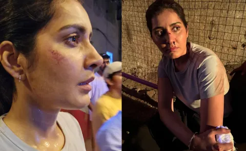 Rashi khanna Injured In Movie Shooting9