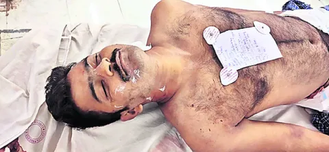 రోడ్డు ప్రమాదంలో గాయపడిన యువకుడు మృతి 
