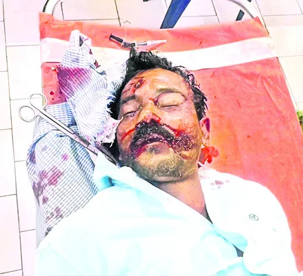పొట్టకూటి కోసం వచ్చి అనంత లోకాలకు.. 