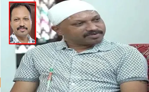 Kerala man battles flesh-eating bacteria After Hair transplant