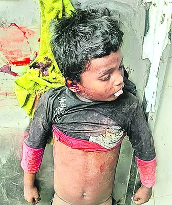 చిన్నారిని చిదిమేసిన నిర్లక్ష్యం 