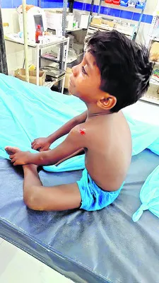 పిచ్చ