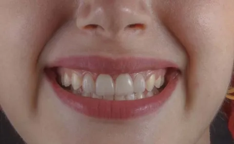 German Man Says Indians Have Good Dental Hygiene Goes Viral15