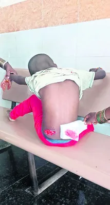మహిళపై దాడి: కేసు నమోదు 

