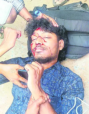 జీడిప