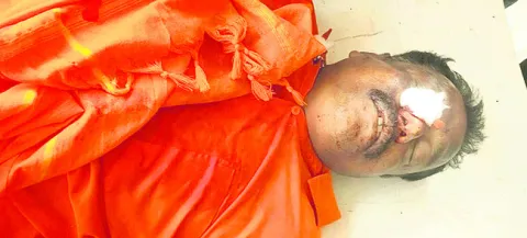 ఆర్టీ