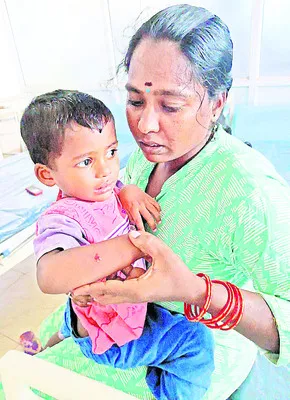 చిన్నపిల్లలపై పిచ్చి కుక్క దాడి 
