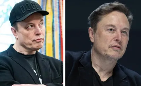 Elon Musk Black Eye Mystery13