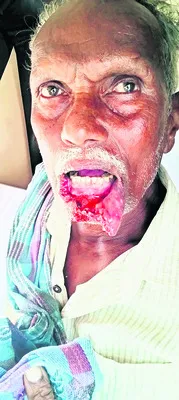 ఇద్దరిపై పిచ్చి కుక్క దాడి