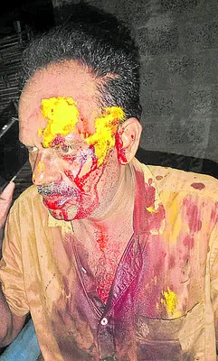 ఆర్టీసీ డ్రైవర్‌పై దాడి 