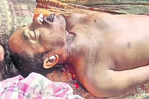 రేపు 