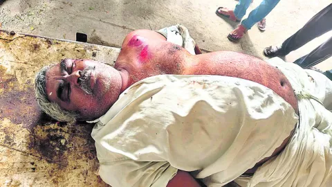ఆటో బోల్తాపడి ఒకరి మృతి