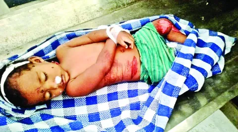 ప్రమాదంలో చిన్నారి మృతి 
