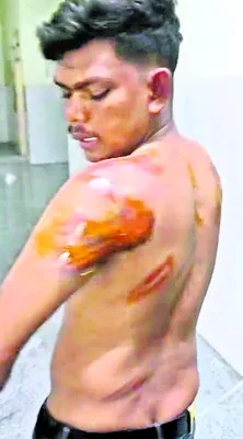 రోడ్డు ప్రమాదంలో  ఐదుగురికి గాయాలు