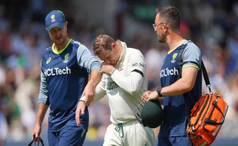 Steve Smith picks up nasty injury after risky attempt at slips on Day 37