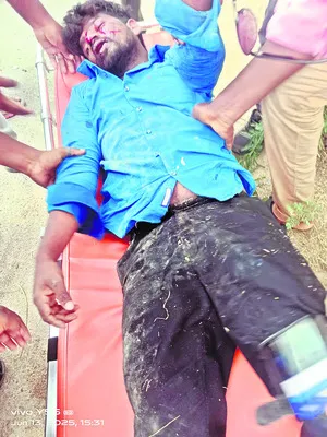 రోడ్డు ప్రమాదంలో ఒకరికి తీవ్ర గాయాలు
