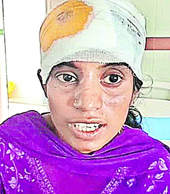 మద్యం మత్తులో రాళ్లతో దాడి 