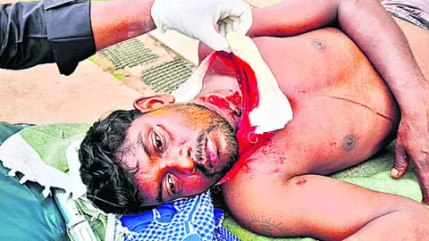 యువకుడిపై బీర్‌ బాటిల్‌తో దాడి