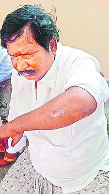 వైఎస్సార్‌ సీపీ కార్యకర్తలపై దాడి 