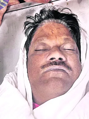 పాము కాటుతో స్టీల్‌ప్లాంట్‌ ఉద్యోగి మృతి 