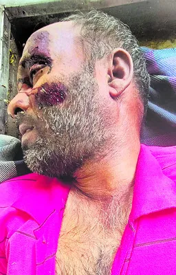 కారు ఢీకొని డీసీఎం డ్రైవర్‌ మృతి 