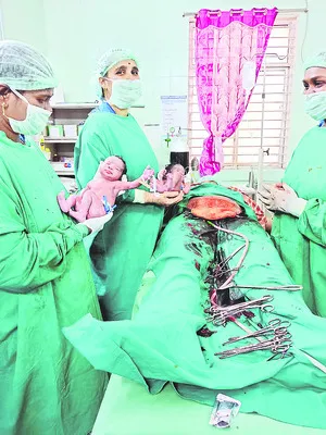 క్రిటికల్‌ సర్జరీ.. కవలలు సురక్షితం 