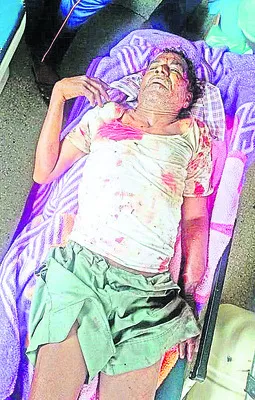 తండ్రిపై తనయుడి కొడవలితో దాడి