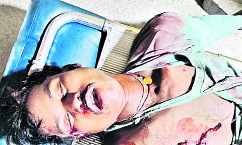 లారీ ఢీకొని యువకుడికి తీవ్ర గాయాలు 