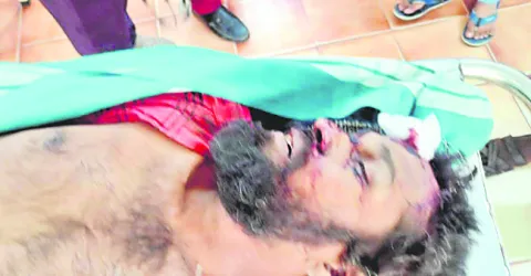 రోడ్డ